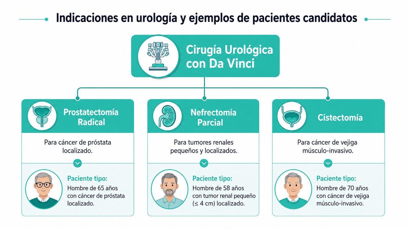 Infografía sobre indicaciones de la cirugía urológica robótica Da Vinci para próstata, riñón y vejiga.