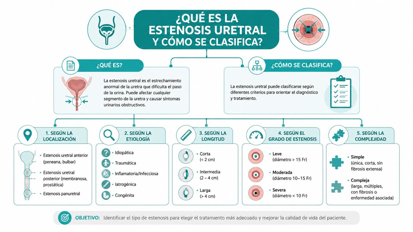 Infografía explicativa sobre la estenosis uretral, sus definiciones, clasificaciones clínicas y criterios de diagnóstico médico.