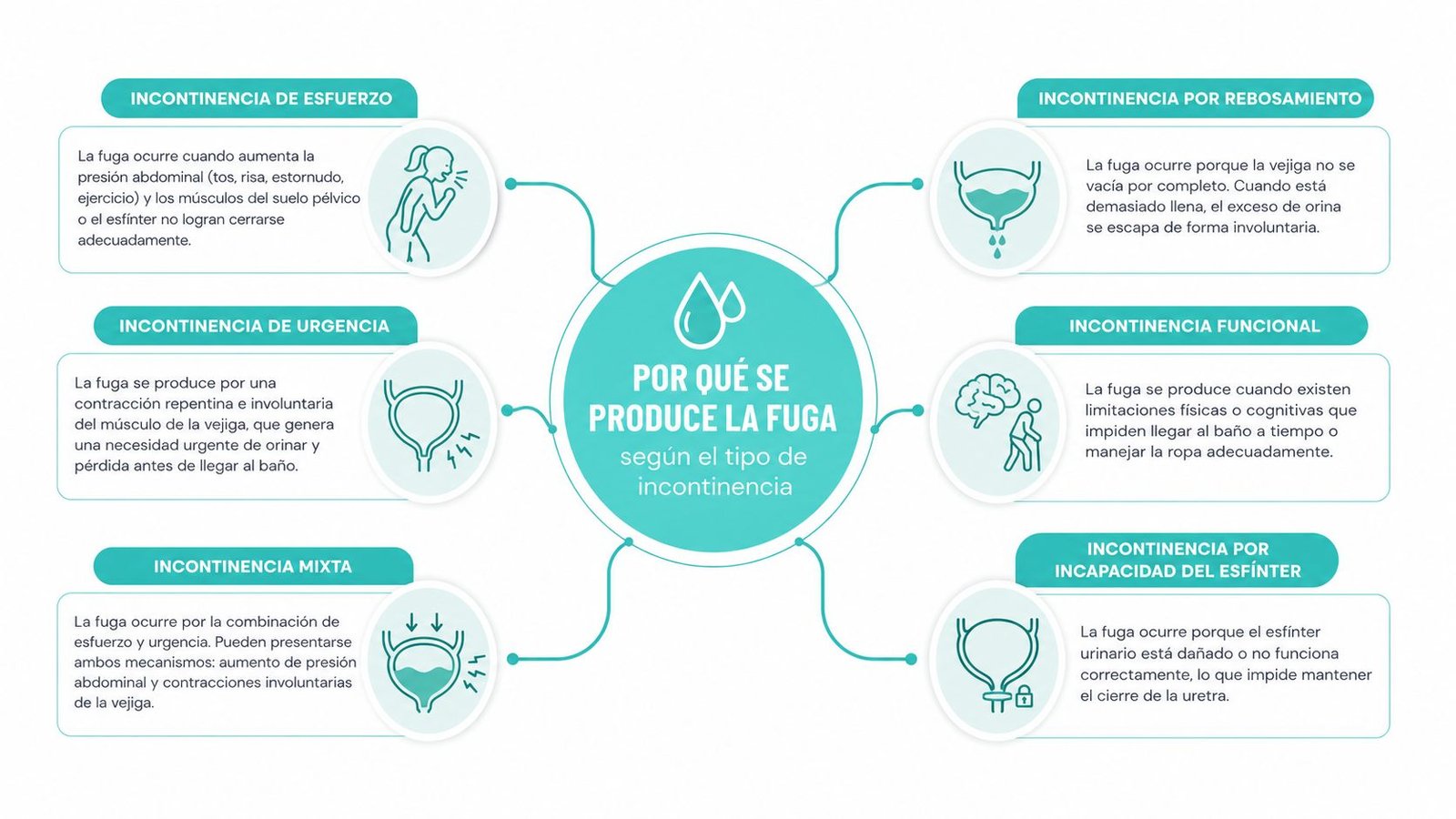 Infografía sobre las causas de la incontinencia urinaria clasificadas según el tipo de incontinencia.