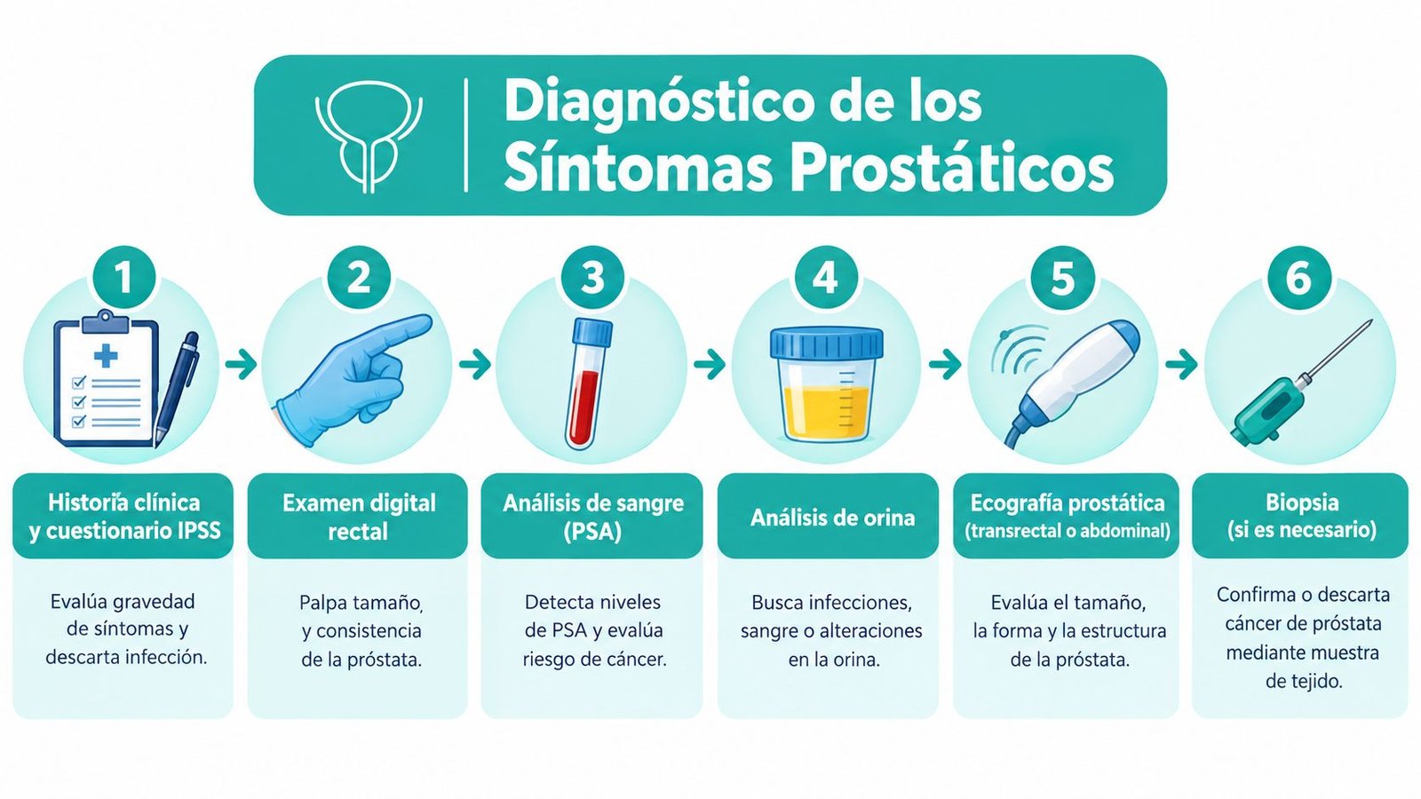 Infografía que muestra los seis pasos básicos del proceso diagnóstico de los síntomas prostáticos médicos.