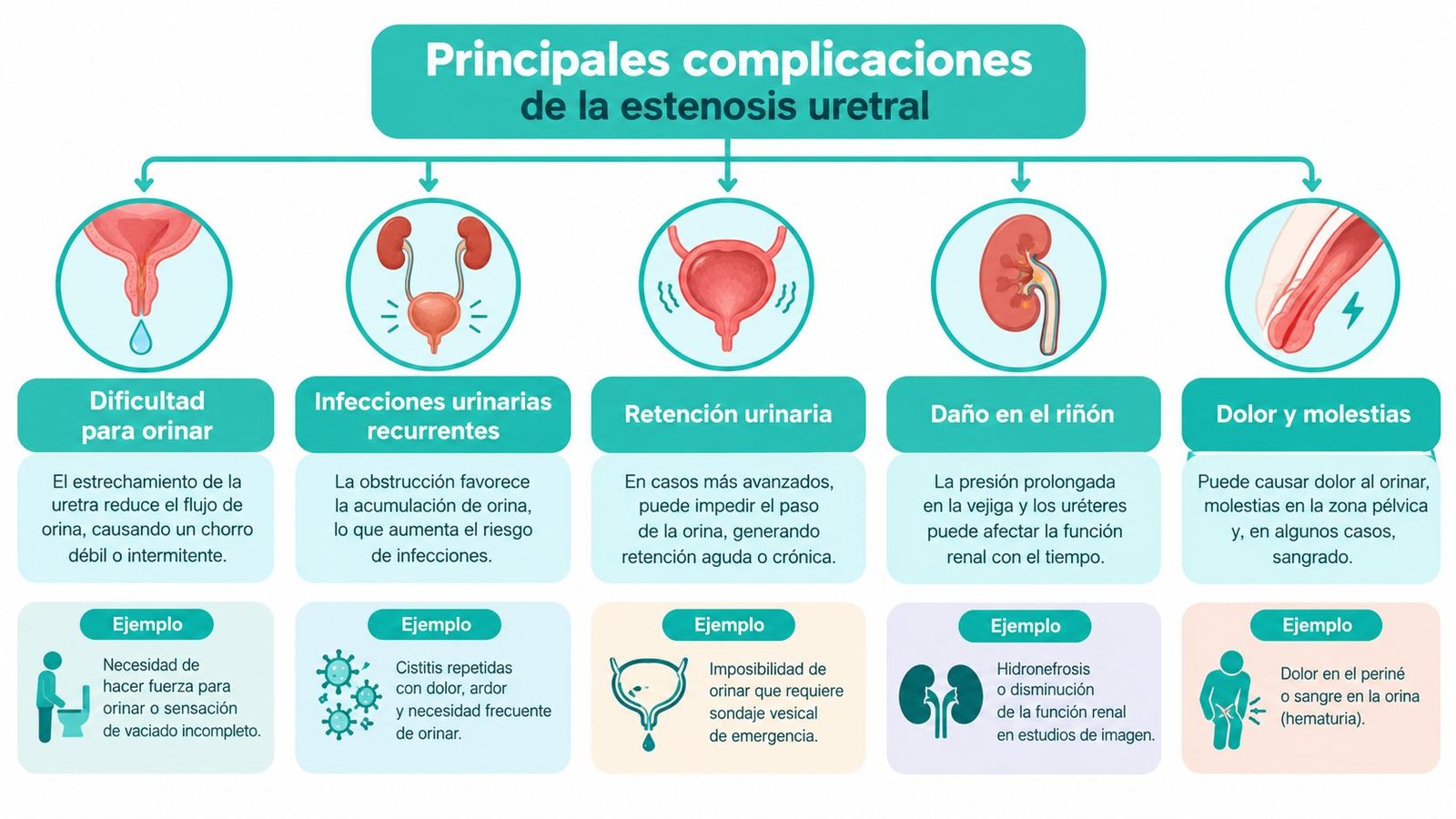 Infografía sobre las principales complicaciones de la estenosis uretral, incluyendo infecciones, retención, daño renal y dolor.